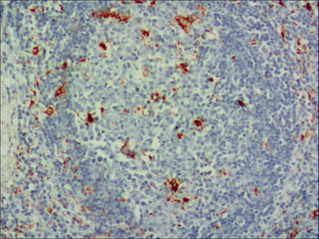 中杉金桥ZM-0464CD68 小鼠抗人CD68单克隆抗体 Mouse anti- CD68（PG-M1）Monoclonal Antibody