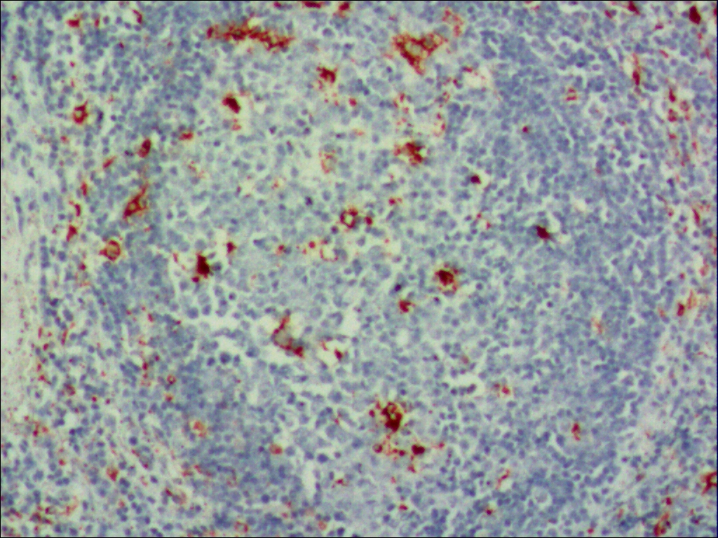 中杉金桥ZM-0464CD68 小鼠抗人CD68单克隆抗体 Mouse anti- CD68（PG-M1）Monoclonal Antibody