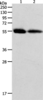Anti-MMP11 antibody