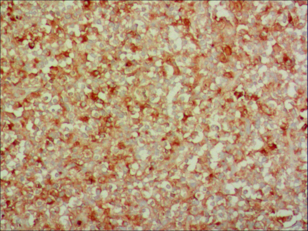 中杉金桥ZA-0135GH 兔抗人生长激素多克隆抗体 Rabbit anti-GH（Growth Hormone）Polyclonal Antibody