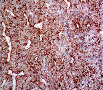 中杉金桥ZM-0312β-LH 小鼠抗人促黄体生成素单克隆抗体 Mouse anti-β- Luteinizing Hormone（β-LH）Monoclonal Antibody