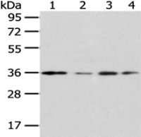 Anti-HOXD13 antibody
