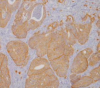 中杉金桥ZM-0364Claudin-4 小鼠抗人Claudin-4单克隆抗体 Mouse anti-Claudin-4 Monoclonal Antibody