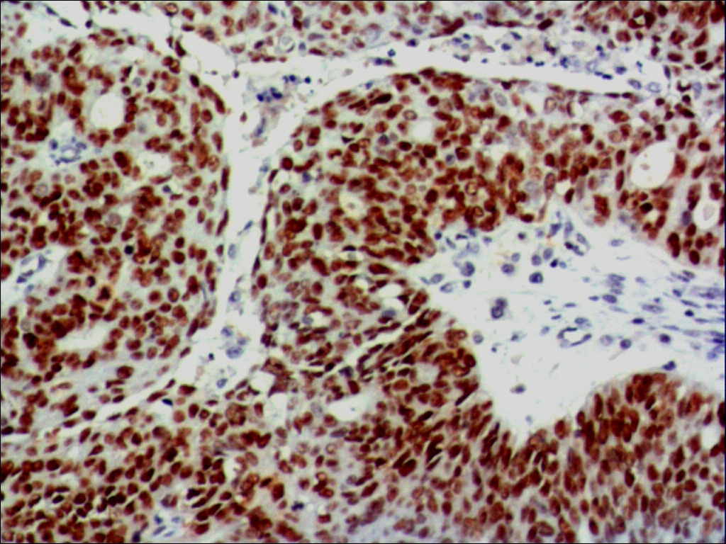 中杉金桥ZM-0405P53 小鼠抗人p53单克隆抗体 Mouse Anti-p53 Protein Monoclonal Antibody