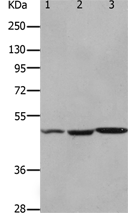 Anti-HCRTR2 antibody