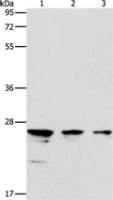 Anti-MOB1B antibody