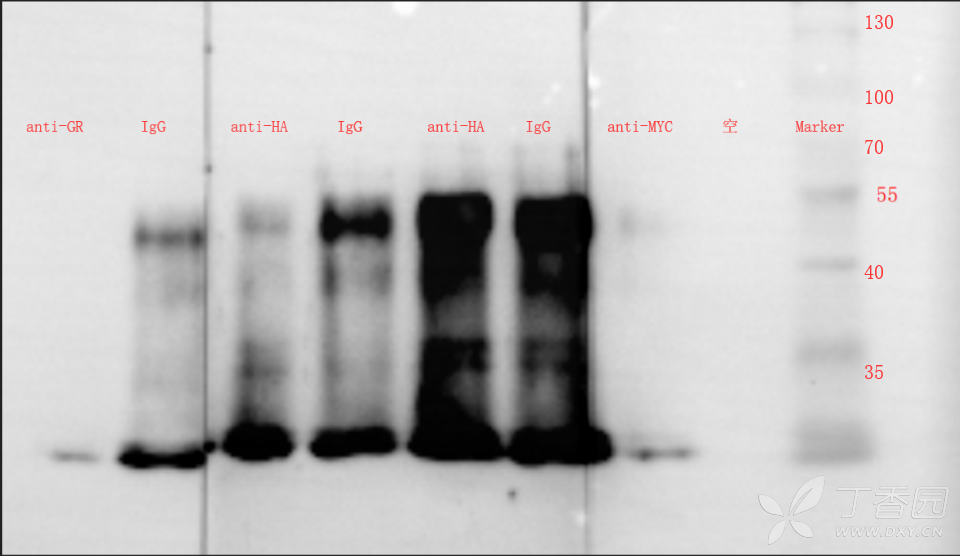 wb图和ip图怎么看