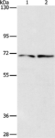 Anti-IFT74 antibody
