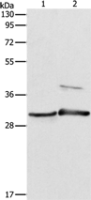 Anti-APOBEC2 antibody