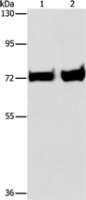 Anti-PCK1 antibody
