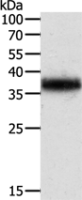 Anti-TPM2 antibody
