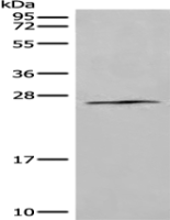 Anti-ANXA2R antibody