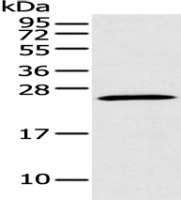 Anti-BNIP3L antibody