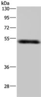 Anti-STK26 antibody