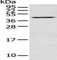 Anti-DNASE2 antibody