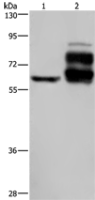 Anti-PCSK9 antibody