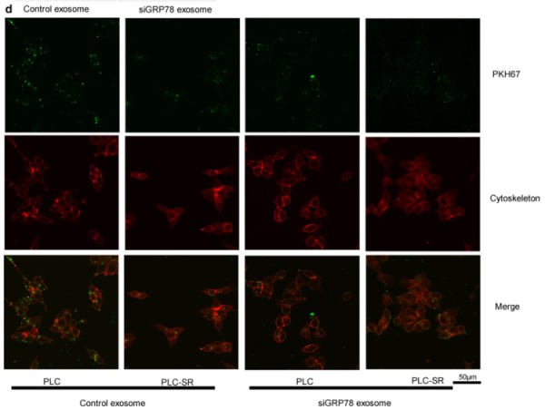 骨髓间充质干细胞＋外泌体＋siRNA＝1 区 SCI