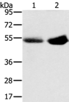 Anti-SLC13A3 antibody