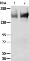 Anti-TRPM6 antibody