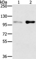 Anti-SLTM antibody