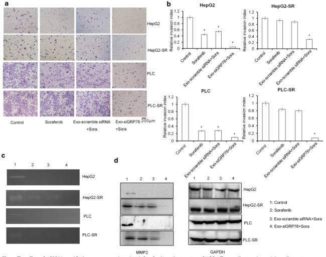 骨髓间充质干细胞＋外泌体＋siRNA＝1 区 SCI