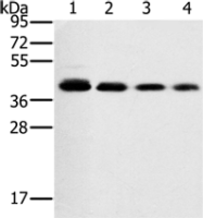 Anti-PTGER1 antibody