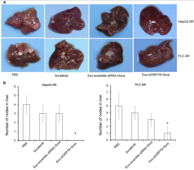 骨髓间充质干细胞＋外泌体＋siRNA＝1 区 SCI