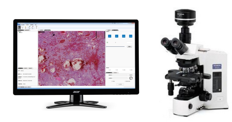 依视显微镜相机扫描带实时拼接景深融合图像处理软件