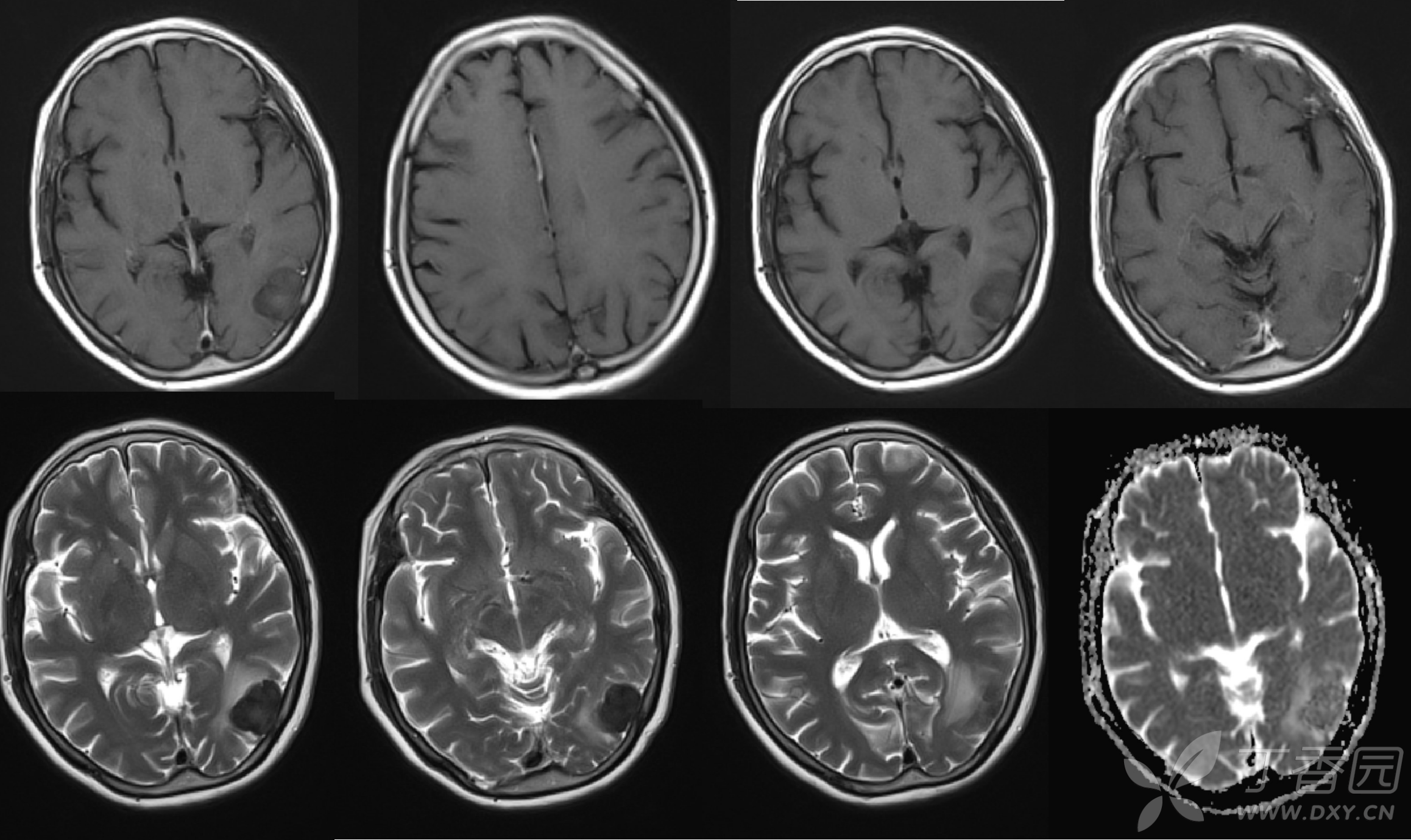 影像医学和核医学讨论版 -丁香园论坛
