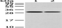 Anti-HNRNPC antibody