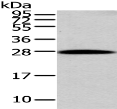 Anti-ZNF365 antibody