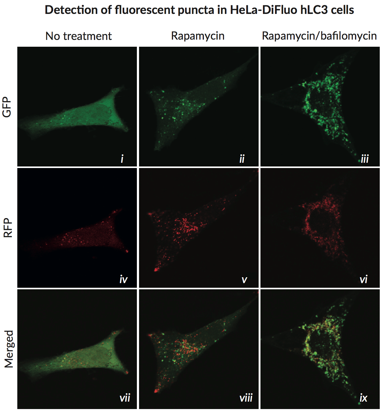 InvivoGen 带您读文献：自噬与天然免疫