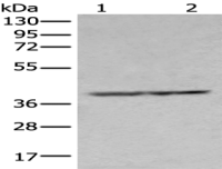 Anti-NUDT19 antibody