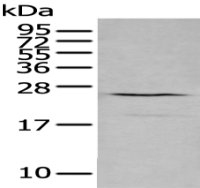 Anti-CXCL16 antibody