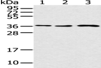 Anti-CCNH antibody