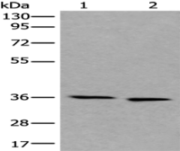 Anti-CDC123 antibody