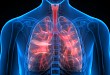 Medscape 精选 |累及肺脏的免疫介导不良反应的治疗