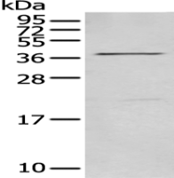  Anti-MAGEB18 antibody