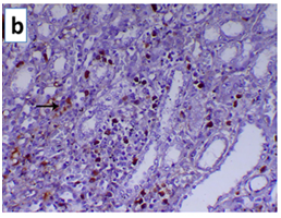 糖尿病肾病大鼠模型