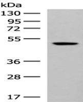 Anti-GPR142 antibody