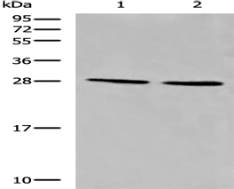 Anti-CYB5D1 antibody