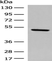 Anti-DCAF13 antibody