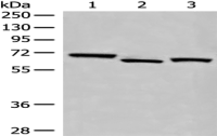 Anti-EEPD1 antibody