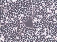 MDA-MB-468细胞、MDA-MB-468细胞、MDA-MB-468细胞