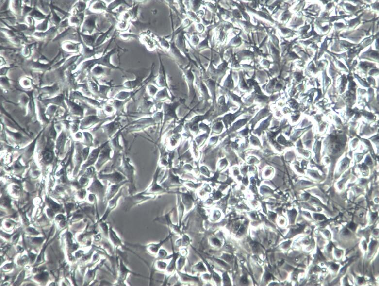 B16-F10、B16F10黑色素瘤细胞、B16-F10细胞
