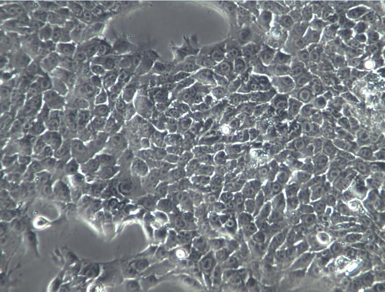 AT-3小鼠乳腺癌细胞、AT-3细胞、AT-3细胞系