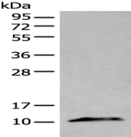  Anti-CXCL10 antibody