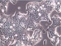 Hep G2细胞、Hep G2细胞、Hep G2细胞