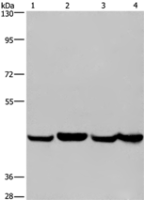 Anti-RBMY1A1 antibody