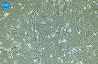 人韧带成纤维细胞/免疫荧光鉴定